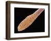 Human Hair Root-Micro Discovery-Framed Photographic Print