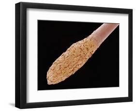 Human Hair Root-Micro Discovery-Framed Photographic Print