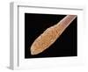 Human Hair Root-Micro Discovery-Framed Photographic Print