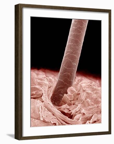 Human hair-Micro Discovery-Framed Photographic Print