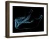 Human Jaw-sauliusl-Framed Art Print