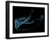 Human Jaw-sauliusl-Framed Art Print