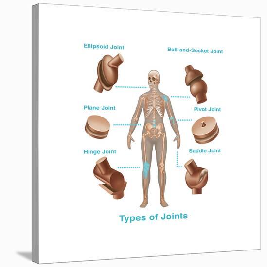 Human Joint Replacements, Illustration-Gwen Shockey-Stretched Canvas