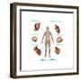 Human Joint Replacements, Illustration-Gwen Shockey-Framed Art Print