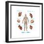 Human Joint Replacements, Illustration-Gwen Shockey-Framed Art Print