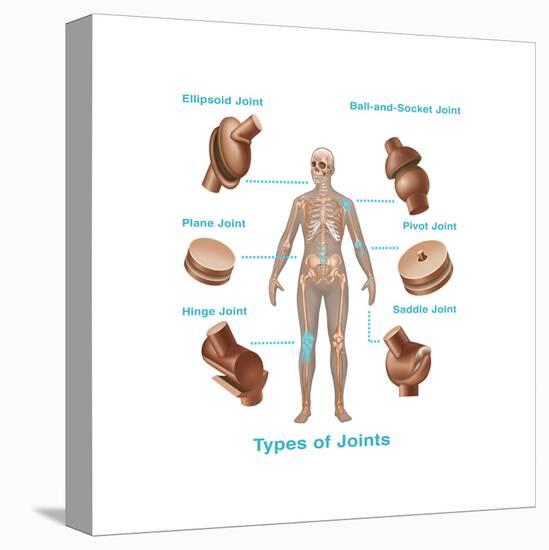 Human Joint Replacements, Illustration-Gwen Shockey-Stretched Canvas