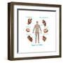 Human Joint Replacements, Illustration-Gwen Shockey-Framed Art Print