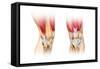 Human Knee Cutaway Illustration-null-Framed Stretched Canvas