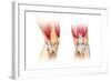 Human Knee Cutaway Illustration-null-Framed Art Print