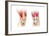 Human Knee Cutaway Illustration-null-Framed Art Print