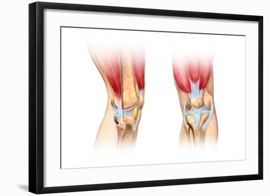 Human Knee Cutaway Illustration-null-Framed Art Print