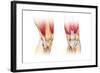 Human Knee Cutaway Illustration-null-Framed Art Print