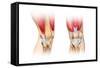 Human Knee Cutaway Illustration-null-Framed Stretched Canvas