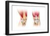 Human Knee Cutaway Illustration-null-Framed Art Print