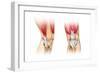 Human Knee Cutaway Illustration-null-Framed Art Print