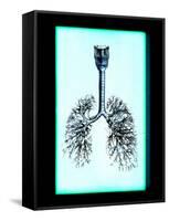 Human Lungs-Neal Grundy-Framed Stretched Canvas