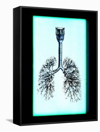 Human Lungs-Neal Grundy-Framed Stretched Canvas