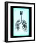 Human Lungs-Neal Grundy-Framed Photographic Print