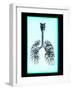 Human Lungs-Neal Grundy-Framed Photographic Print