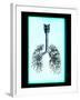 Human Lungs-Neal Grundy-Framed Photographic Print