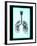 Human Lungs-Neal Grundy-Framed Photographic Print