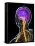 Human Nervous System, Artwork-SCIEPRO-Framed Stretched Canvas