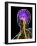 Human Nervous System, Artwork-SCIEPRO-Framed Photographic Print