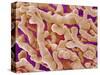 Human Placenta-Micro Discovery-Stretched Canvas