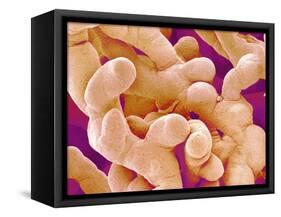 Human Placenta-Micro Discovery-Framed Stretched Canvas