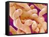 Human Placenta-Micro Discovery-Framed Stretched Canvas