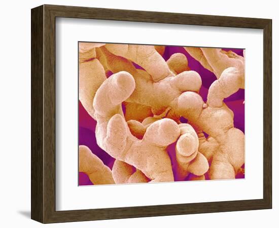 Human Placenta-Micro Discovery-Framed Photographic Print