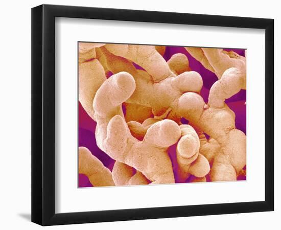 Human Placenta-Micro Discovery-Framed Photographic Print