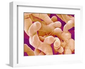 Human Placenta-Micro Discovery-Framed Photographic Print