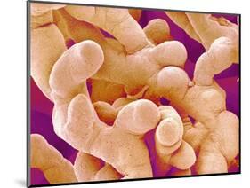 Human Placenta-Micro Discovery-Mounted Photographic Print