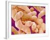 Human Placenta-Micro Discovery-Framed Photographic Print