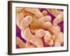 Human Placenta-Micro Discovery-Framed Photographic Print