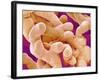 Human Placenta-Micro Discovery-Framed Photographic Print