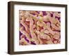 Human Placenta-Micro Discovery-Framed Photographic Print