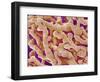 Human Placenta-Micro Discovery-Framed Photographic Print