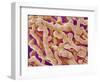 Human Placenta-Micro Discovery-Framed Photographic Print