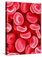 Human Red Blood Cells-Micro Discovery-Stretched Canvas