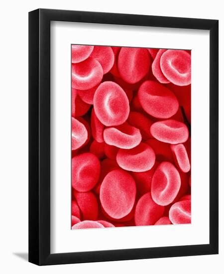 Human Red Blood Cells-Micro Discovery-Framed Premium Photographic Print