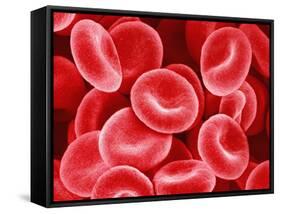 Human Red Blood Cells-Micro Discovery-Framed Stretched Canvas