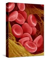 Human Red Blood Cells-Micro Discovery-Stretched Canvas