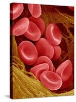 Human Red Blood Cells-Micro Discovery-Stretched Canvas