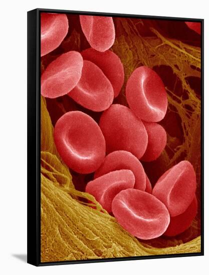 Human Red Blood Cells-Micro Discovery-Framed Stretched Canvas