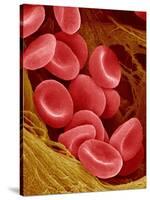 Human Red Blood Cells-Micro Discovery-Stretched Canvas