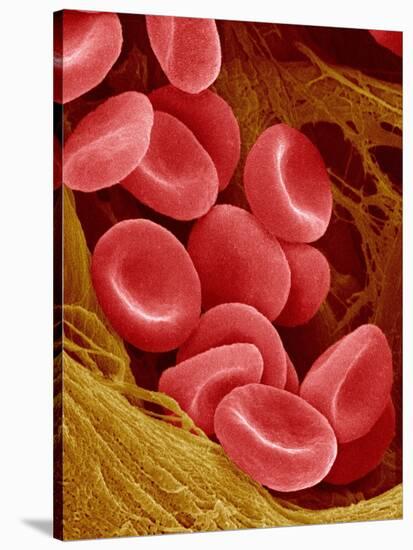 Human Red Blood Cells-Micro Discovery-Stretched Canvas