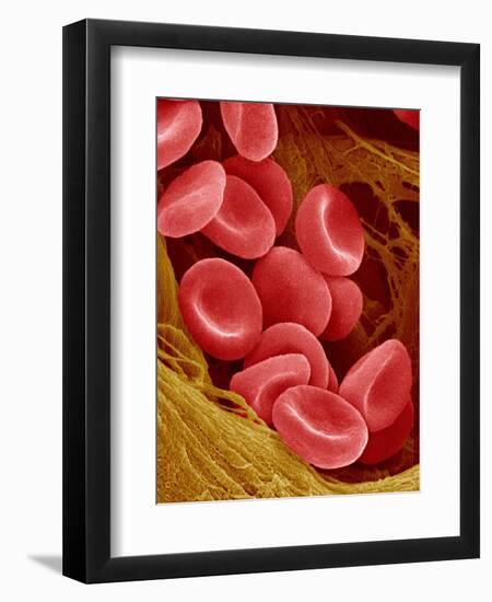 Human Red Blood Cells-Micro Discovery-Framed Premium Photographic Print