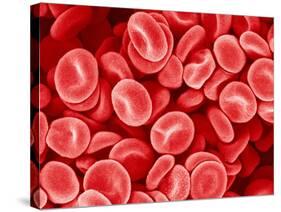 Human Red blood cells-Micro Discovery-Stretched Canvas